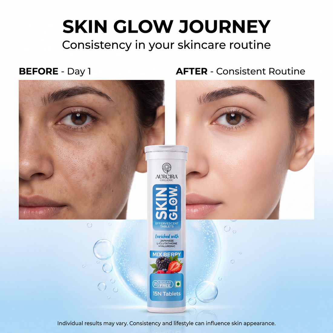 Skin Glow+ Effervescent Tablets with L-Glutathione and Hyaluronic Acid, Mix Berry Flavour, Sugar Free, 15 Tablets